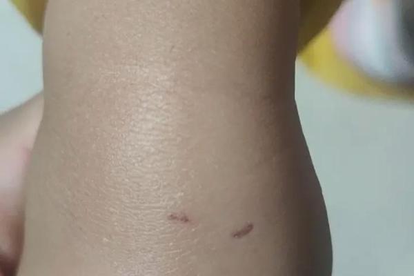 梦到被猫咬是什么征兆 男性 梦到被猫咬是什么征兆 男性