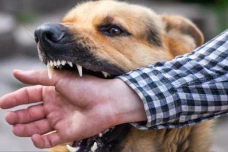 女人梦见狗扑上来咬