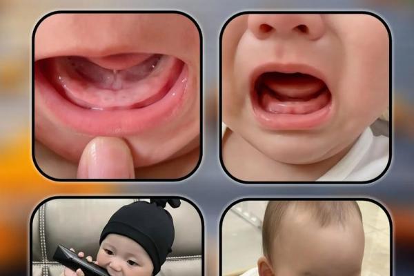 妈妈梦见孩子长牙齿什么意思