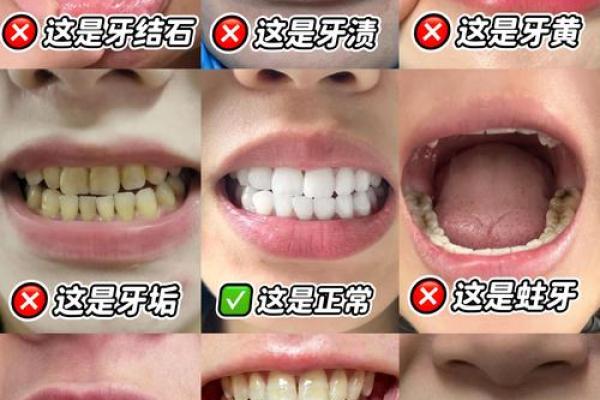 男人梦到全口牙掉光了