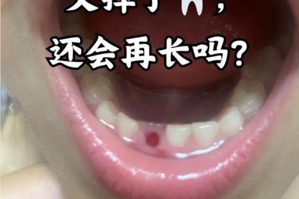 男人梦到全口牙掉光了