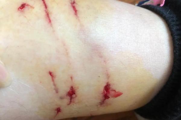 女人梦见猫扑向自己咬 女人梦见猫扑向自己咬