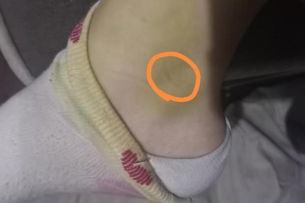 梦见猫抓我是什么预兆 梦见猫抓我是什么预兆