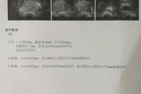 风水调理_一直怀不上孩子怎么办