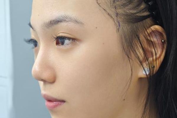 风水上发际线高有福气发际线图片 风水上发际线高有福气发际线图片