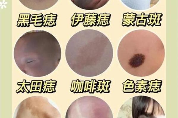 脖子上的胎记算命