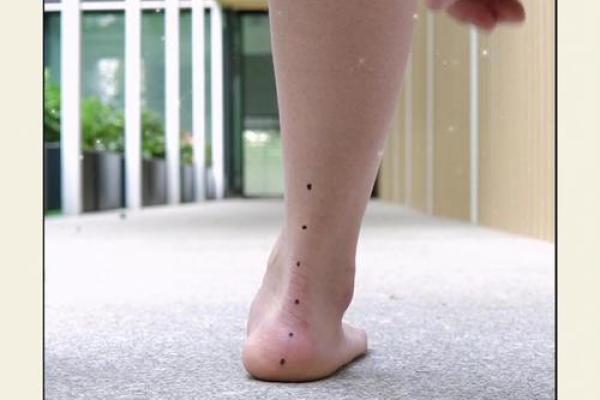 内八字和外八字