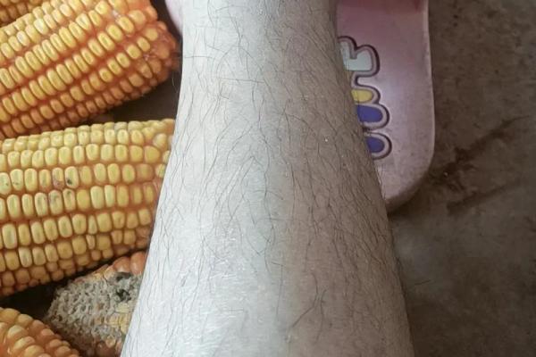 腿上有毛算命 腿上有毛算命