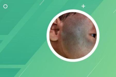 怎么看胎记算命-