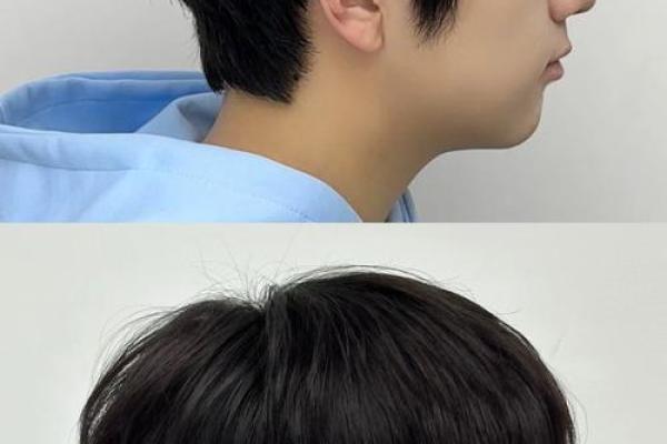 风水上后脑勺长痣代表什么意思 风水上后脑勺长痣代表什么意思