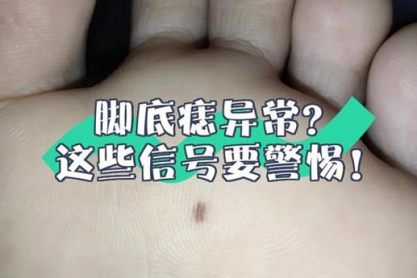 痣相风水脚底有痣的人命运好不好