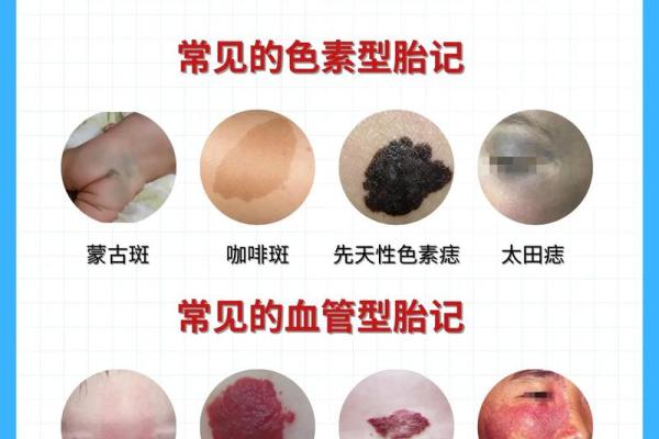 胎记算命的位置与命运